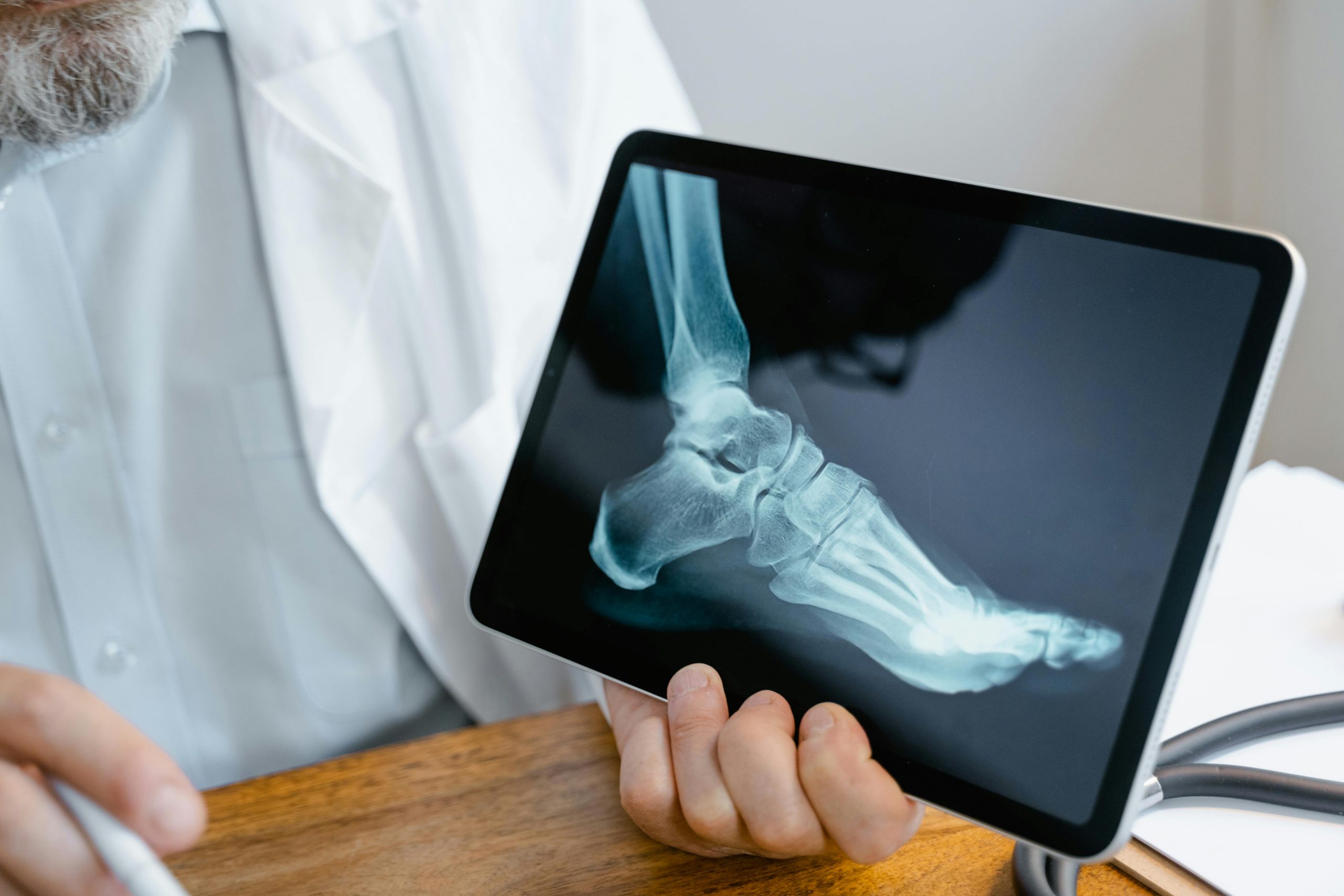 doctor holding a tablet displaying an X-ray of a broken ankle